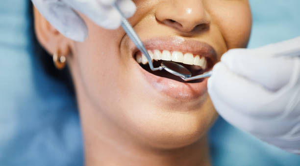 Best Emergency Dental Care for Sports Injuries in Madera Acres, CA