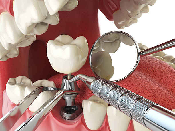 Reliable CA Emergency Dental Service Solutions
